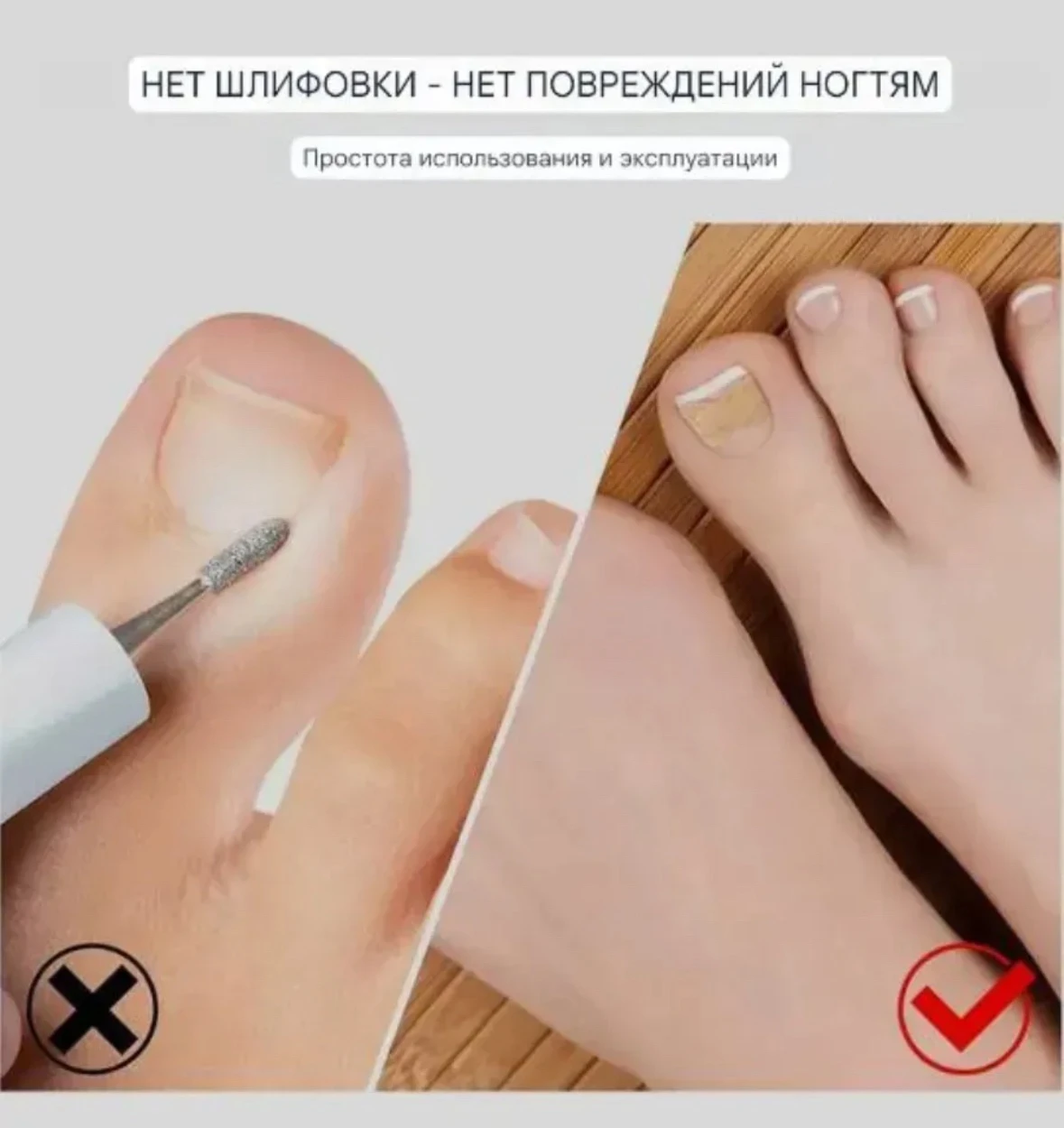 Пластыри для ногтей