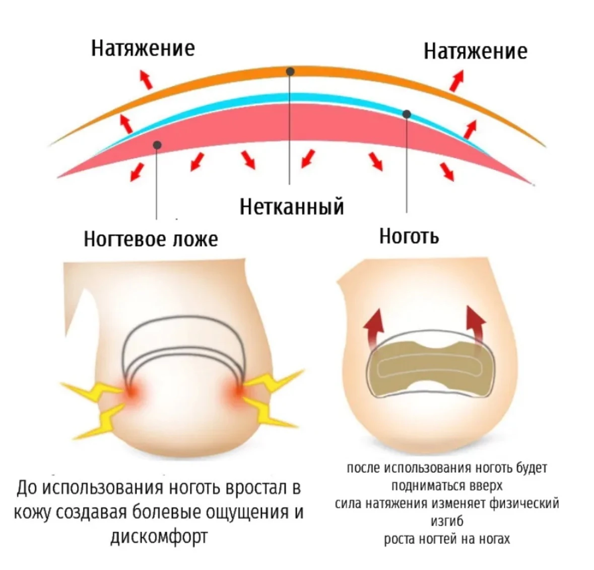 Пластыри для ногтей