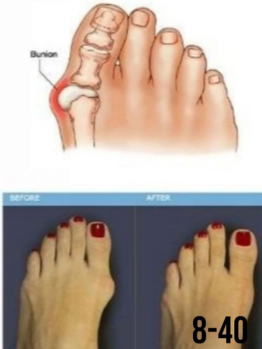 Фиксатор пальца Good Night Bunion